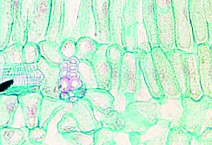 Cell under microscope
